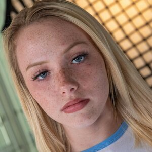 Pale Freckled Girls